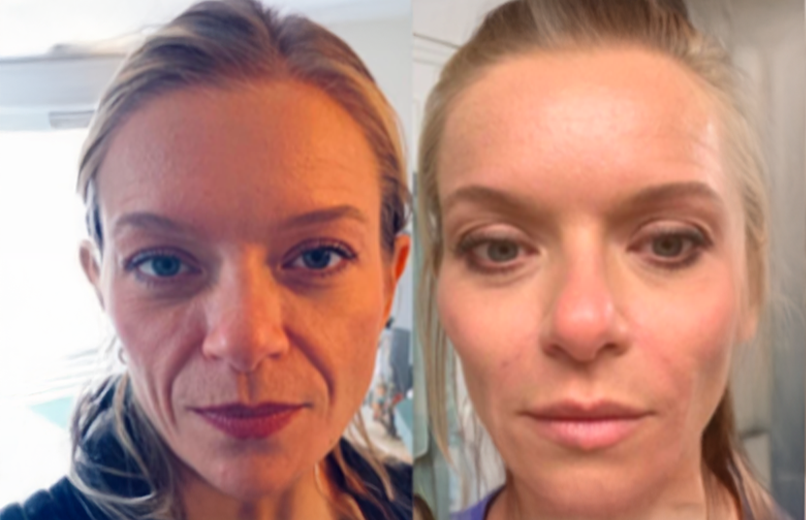 Skin vitality improvement results