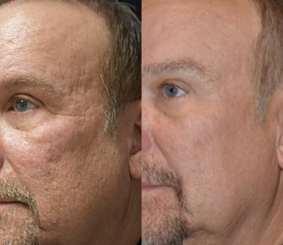 Fast Results
